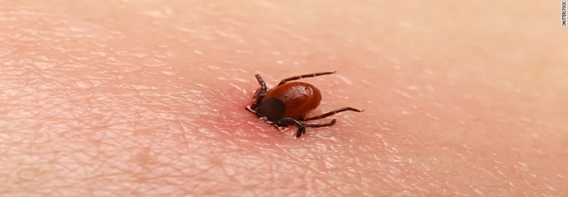 Tick removal services in Toronto area by QAPC.