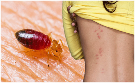 To help you better understand, here are seven benefits of calling professional bed bug exterminators.